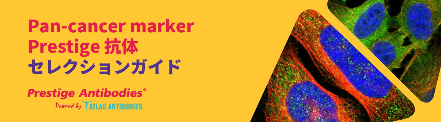 Pan-cancer marker Prestige抗体セレクションガイド